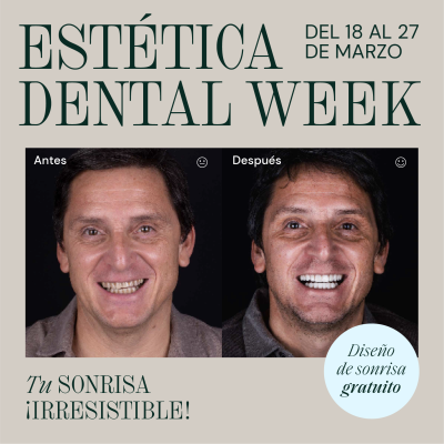 ESTÉTICA DENTAL WEEK 18 al 27 de marzo en Clínica MAEX Cuevas Queipo - Málaga