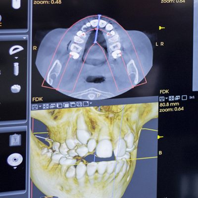 3D ortodoncia Clínica Cuevas Queipo